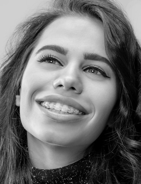 A brunette woman smiling who has Damon clear braces on her teeth.