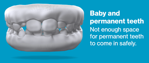 3d model of baby and permanent teeth