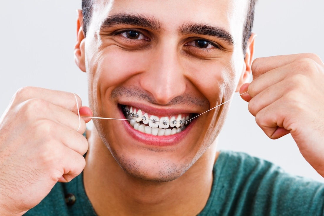 Man flossing teeth with metal braces