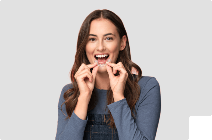 Clear Aligners