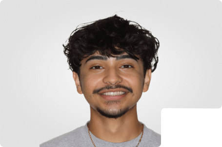 A teen boy smiling with straight white teeth after finishing metal braces treatment.