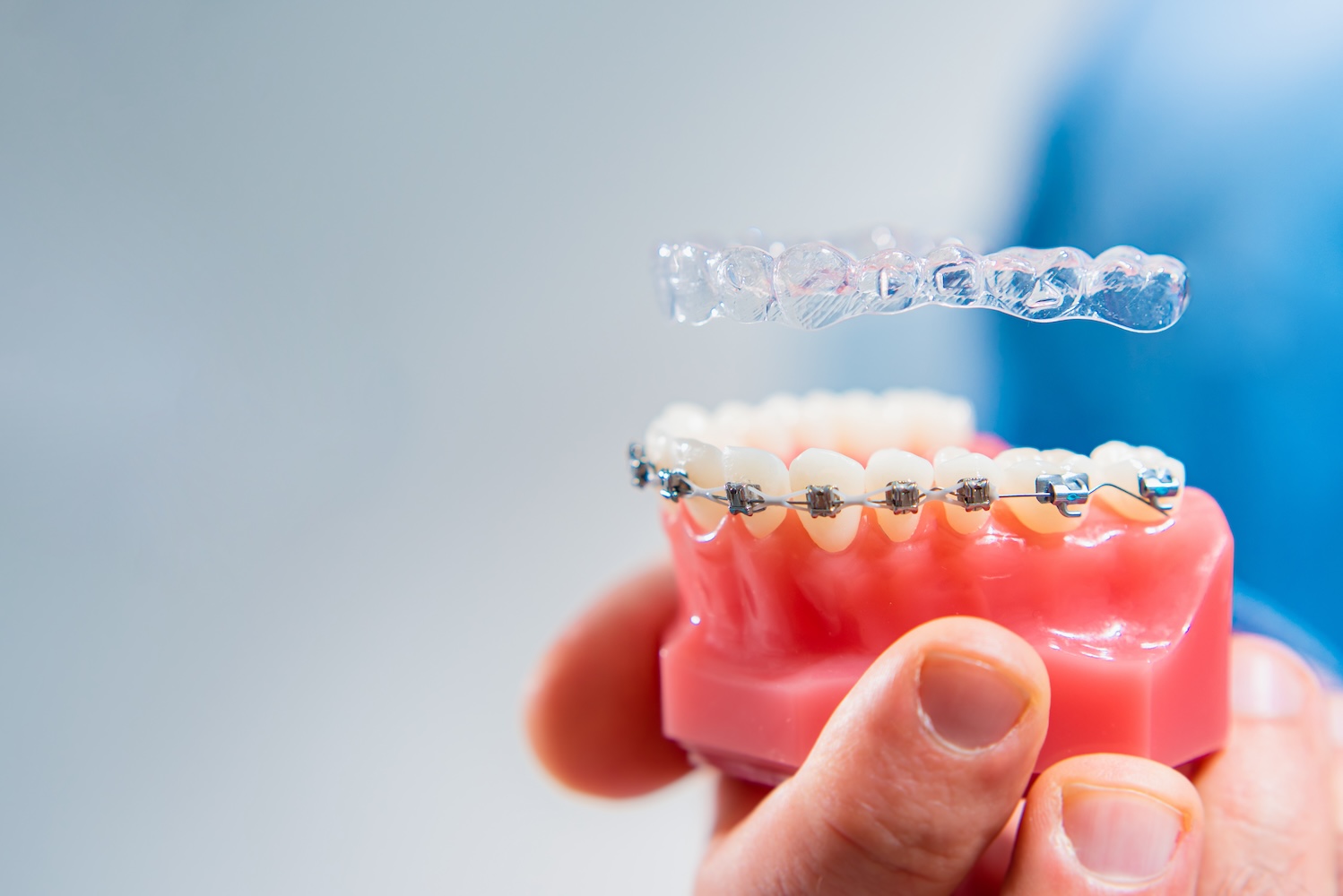 Hand holding model teeth with metal braces with clear aligner floating above.