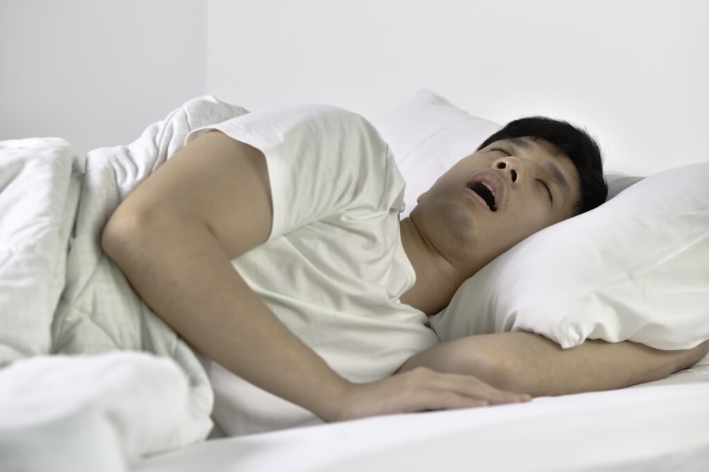 Man sleep with sleep apnea resting in bed with mouth open.