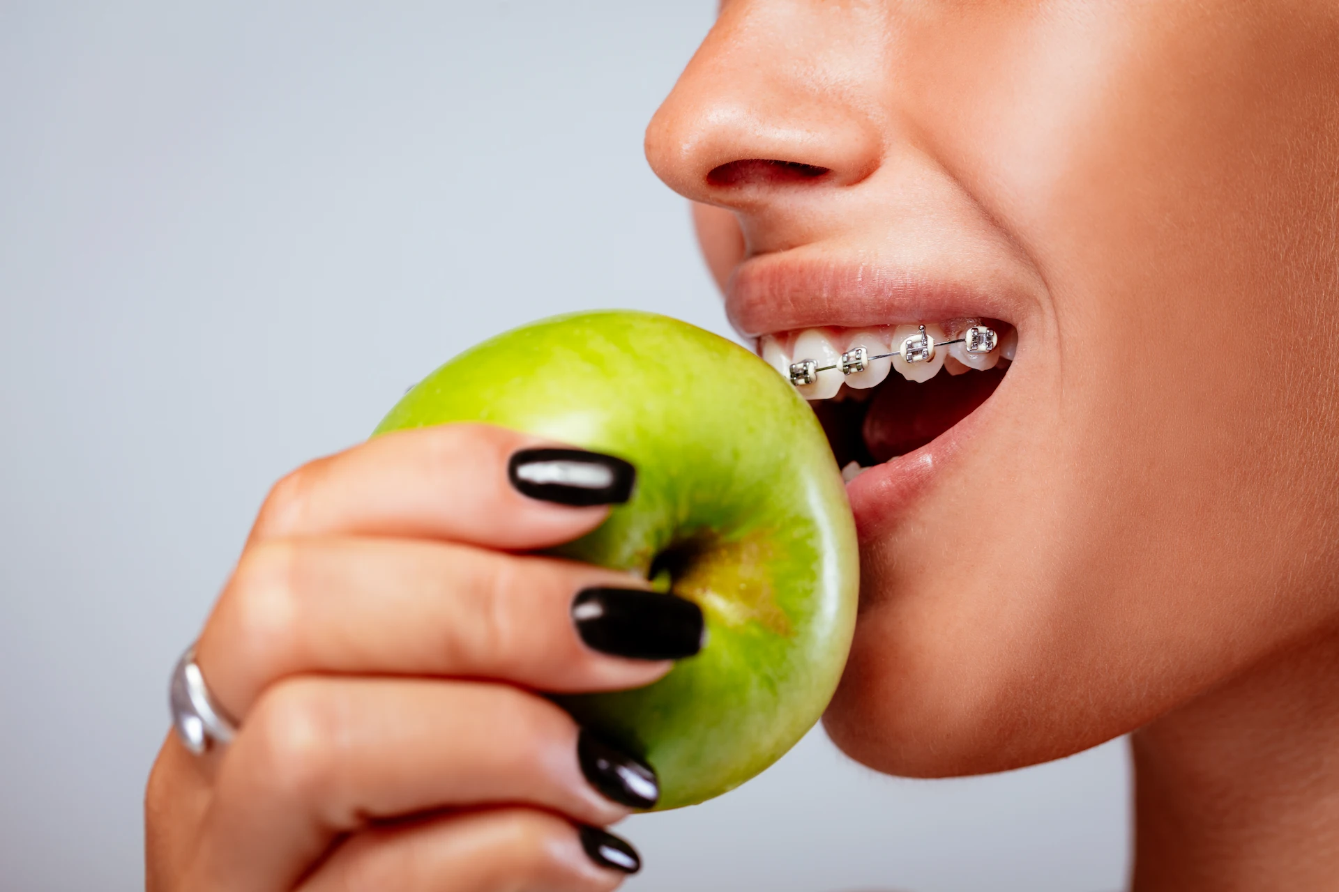 Close up of a girl wearing braces about to eat an apple.